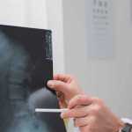 quadriplegia injury attorneys