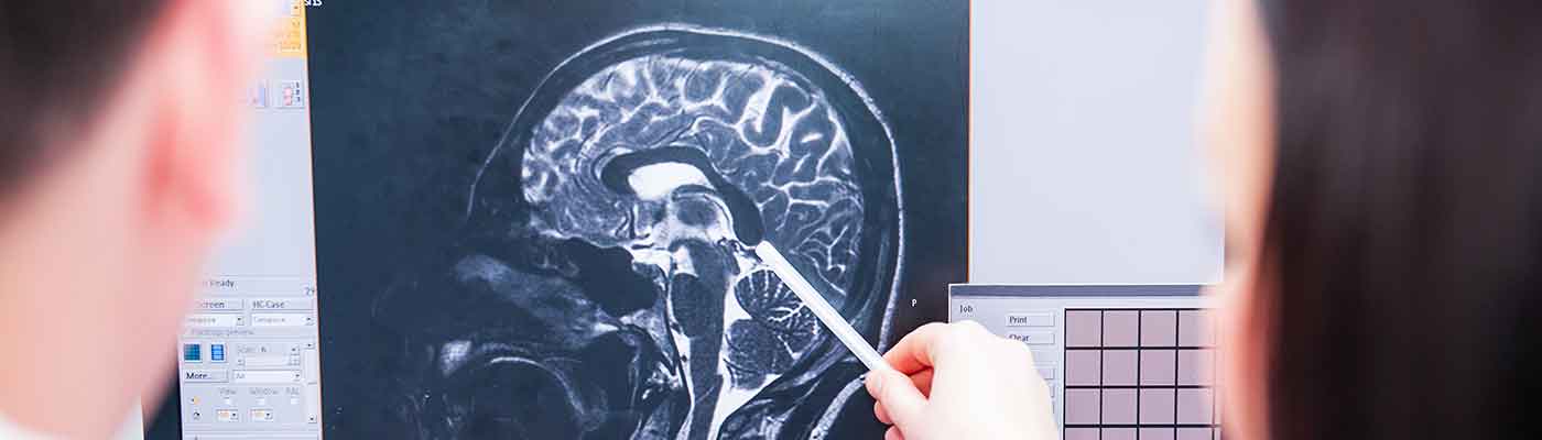 How an Attorney Can Help After a Brain Injury