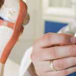 hip replacement attorneys