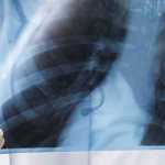 medical malpractice attorneys