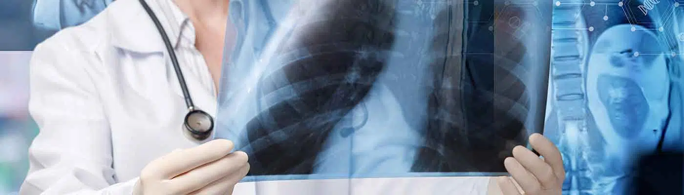 Radiology Mistake Attorneys