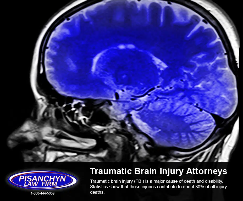 Traumatic Brain Injury Attorneys