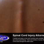 spinal